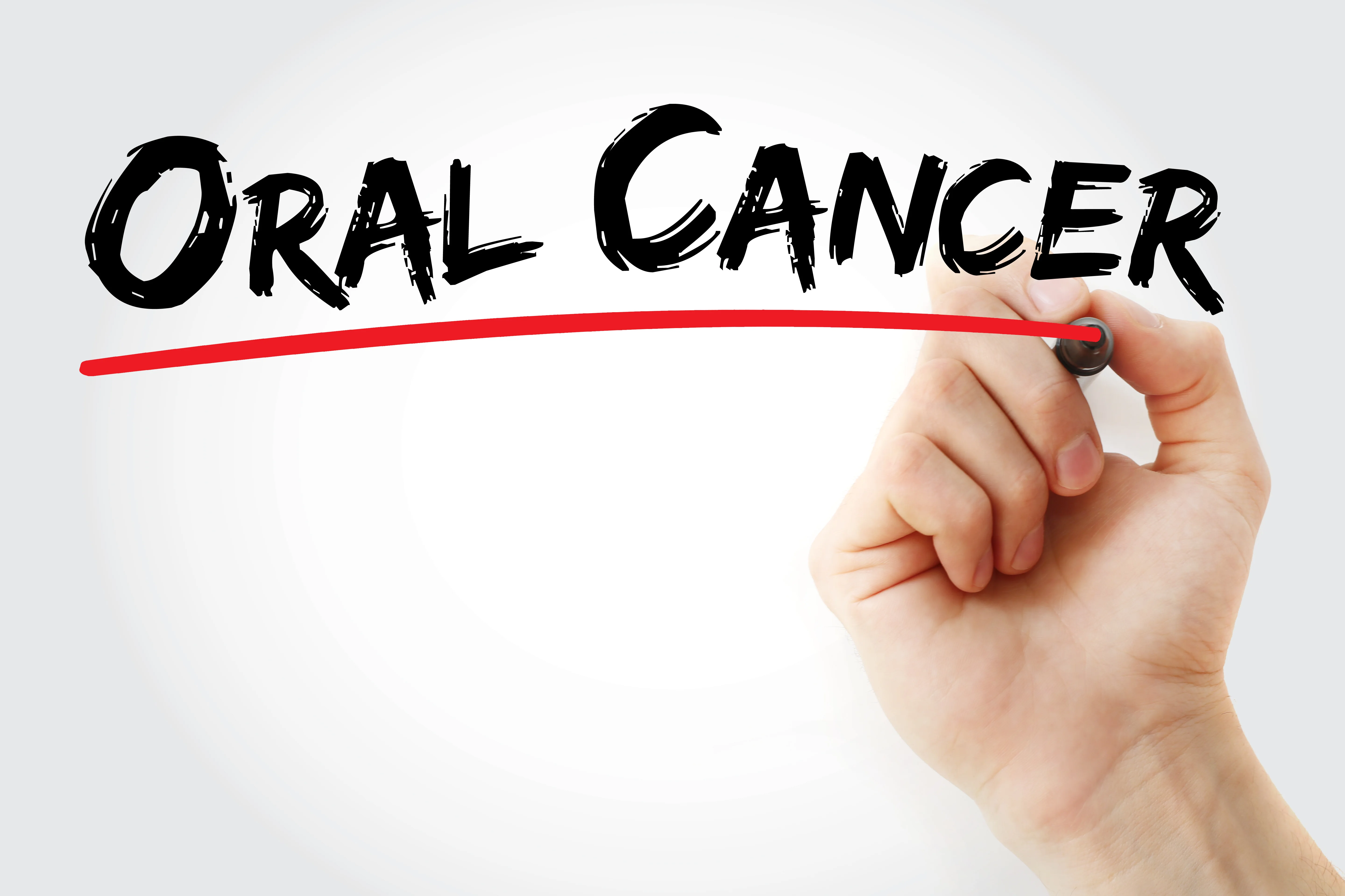 Oral ID Oral Cancer